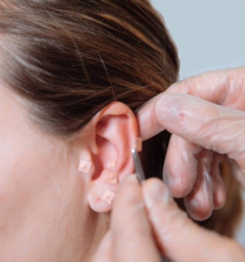 auriculoterapia Fitoterapia